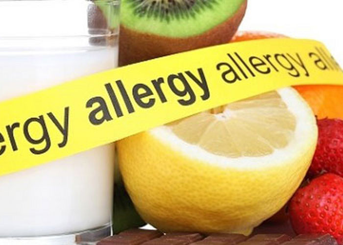 Gıda İntoleransı Testi